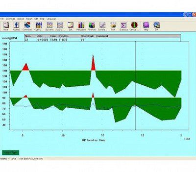 دستگاه هولتر مانیتورینگ فشارخون ABP-700