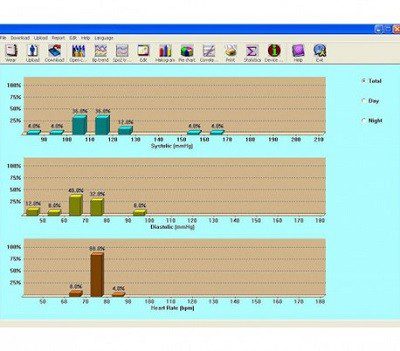 قیمت خرید دستگاه هولتر مانیتورینگ فشارخون ABP-700